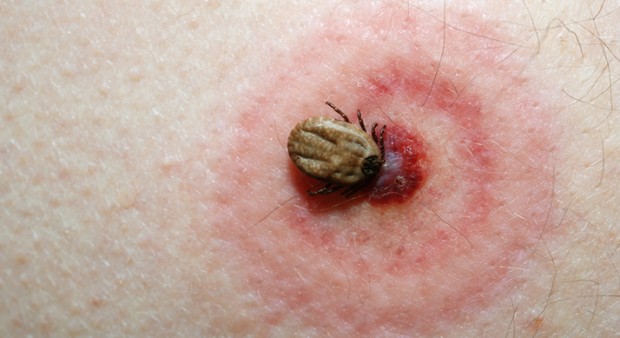 tick on a skin